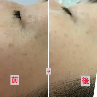 たるみ改善小顔エステ 堀葉月のその他イメージ