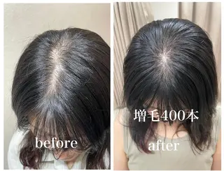 セミロング GRAZIE所属・分け目・つむじ 自然増毛専門のヘアスタイル