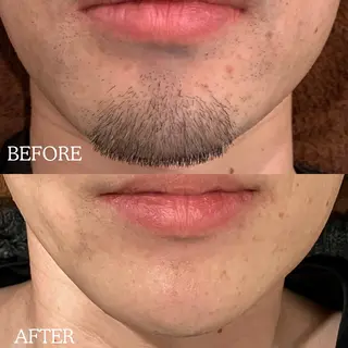 メンズ RICCO 堺東所属・RICCO 堺の眉毛・アイブロウイメージ