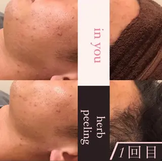 in you所属・in you三軒茶屋 YUKOのエステ・リラクイメージ