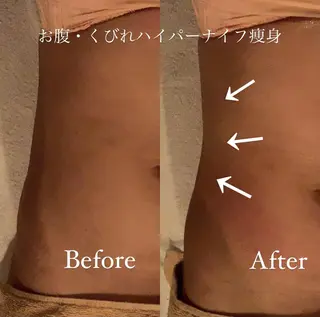 ワックス脱毛 ♡AYO♡のエステ・リラクイメージ