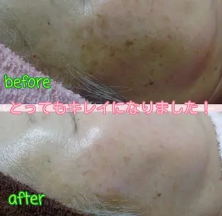 ヨサパーク パール所属・浅尾 順子のエステ・リラクイメージ