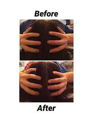 ３歳～フォト美肌脱毛 Dione湘南藤沢店のエステ・リラクイメージ