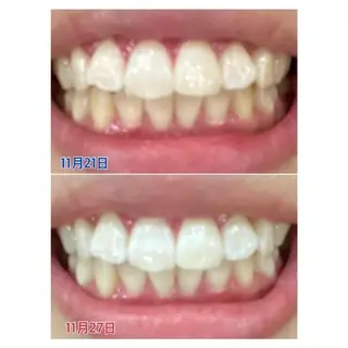 M渋谷店所属・M渋谷 ホワイトニングのエステ・リラクイメージ