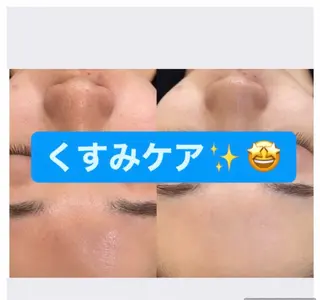 WAC 黒野のエステ・リラクイメージ