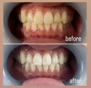 SESUNNY セサニー　AYUKAのマツエク・マツパデザイン