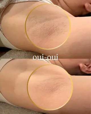oui-oui　ウィウィ所属・oui-oui 磐田脱毛のエステ・リラクイメージ