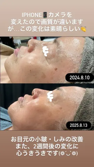 LiZA エステティックサロンのエステ・リラクイメージ