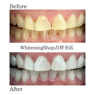 ホワイトニング ショップ吉祥寺店のエステ・リラクイメージ