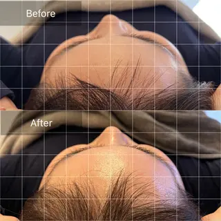 Belulu所属・Belulu ベルルのネイルデザイン