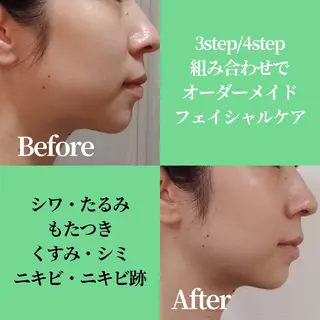 ICHOOSE/ 代々木上原のエステ・リラクイメージ