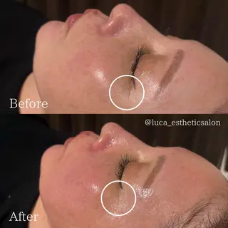 Luca所属・Luca ﾙｶのエステ・リラクイメージ