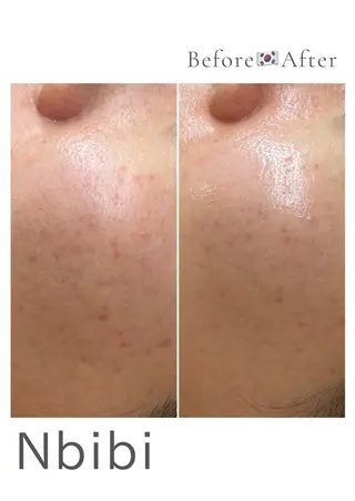 韓国🇰🇷価格 サロン_Nbibiのエステ・リラクイメージ