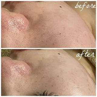 メンズ メナード岐阜茜部 杉浦のエステ・リラクイメージ