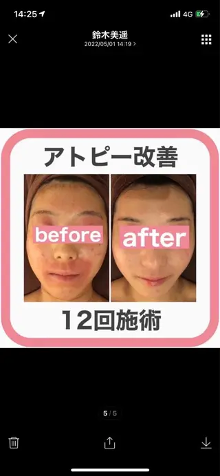 ショート カラー パーマ ヘアアレンジ メンズ キッズ ネイル マツエク・マツパ アイブロウ ニキビ特化型エステ 🍓最短で肌質改善のエステ・リラクイメージ