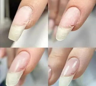 セミロング ネイル フィルイン、長さ出し 深爪矯正のネイルデザイン