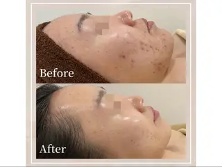 chou cherie所属・🌈肌質改善サロン. manami🌈のエステ・リラクイメージ