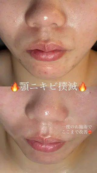 chouchou【シュシュ】所属・トータルボディケア chouchouのエステ・リラクイメージ