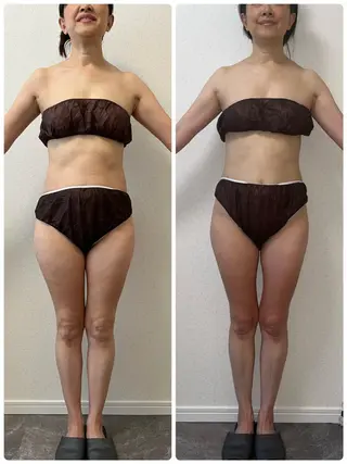 LILISHA 赤坂のエステ・リラクイメージ