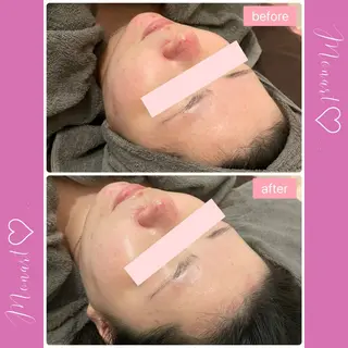 Monart -deux-のエステ・リラクイメージ