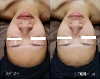 ALOHA RETREATのエステ・リラクイメージ