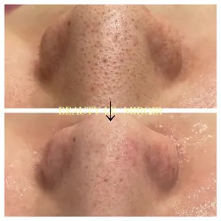 ビューティー ミロワールのエステ・リラクイメージ