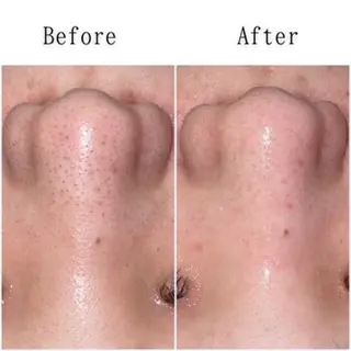 まつ毛/眉毛 🎀RINA🎀のマツエク・マツパデザイン