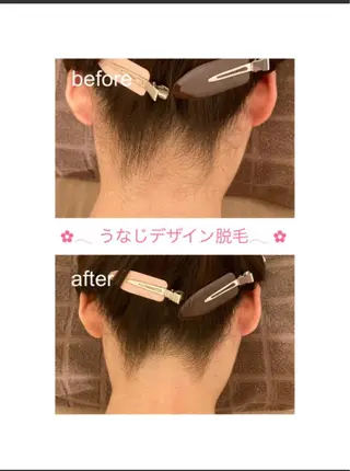 メンズ 都度払い脱毛⭐️ 脱毛サロンMIRACのエステ・リラクイメージ