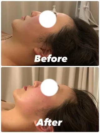 毛穴&ニキビケア 専門ルナボーテ渋谷のエステ・リラクイメージ