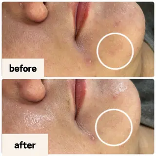 お肌と歯のサロン　Sona Mior所属・藤井 ののみのエステ・リラクイメージ