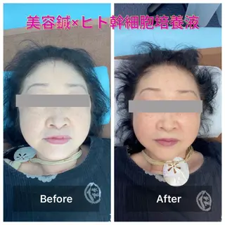 gomi sayakaのエステ・リラクイメージ