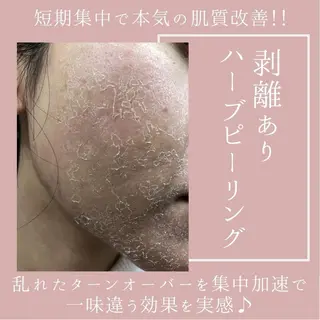 肌質改善サロン renew所属・肌質改善サロン renew/ｳｴｷのエステ・リラクイメージ