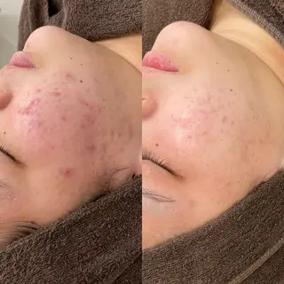 エステサロンTug高知駅前店所属・Tug 高知駅前店/ NANAMIのその他イメージ