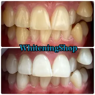 ホワイトニング ショップ吉祥寺店のエステ・リラクイメージ