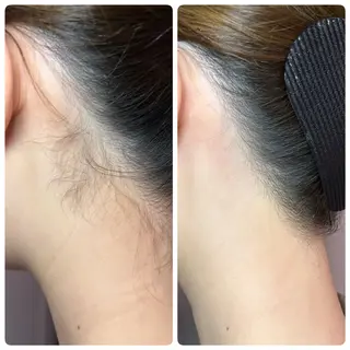 A"-HILU(アーヒル)所属・A"-HILU （アーヒル)のエステ・リラクイメージ