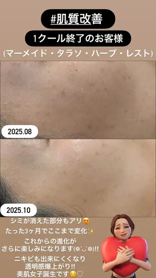 LiZA エステティックサロンのエステ・リラクイメージ