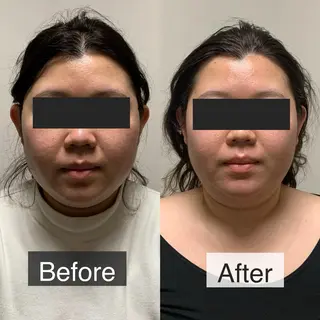 脱毛専門サロン BELFINE恵比寿のエステ・リラクイメージ