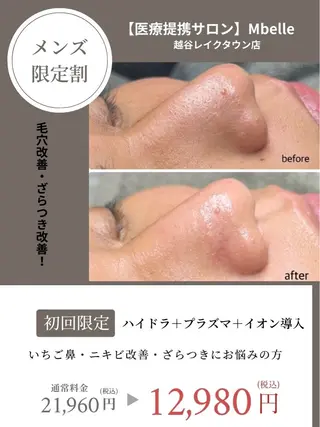 【医療提携サロン】Mbelle所属・フェイシャルサロン 三沢のその他イメージ