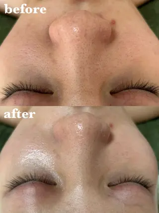 【肌質改善サロン】 リーフィアのエステ・リラクイメージ