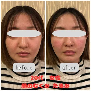 まつもと美容鍼灸整体サロン所属・松本 翔太のエステ・リラクイメージ