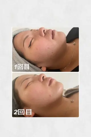 松山 碧のエステ・リラクイメージ