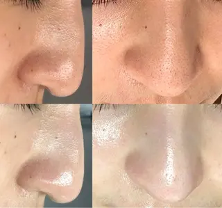 アイラッシュ＆フェイシャルサロン　ベアトリーチェ所属・医療提携美容サロン Beatriceのエステ・リラクイメージ