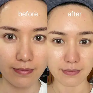 aliaハイフ&水光ジェットサロン所属・aliaハーブ水光店 エステティシャン募集のエステ・リラクイメージ