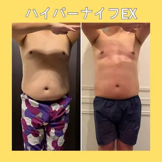 赤澤/本気痩せ・脱毛 ・ノーファンデ肌のその他イメージ