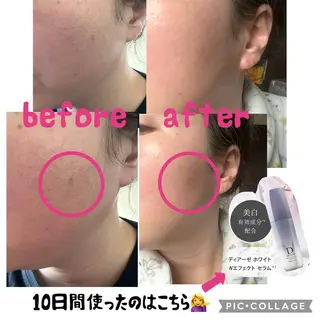 ROR所属・ROR nailのエステ・リラクイメージ