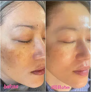 フィユ所属・〚博多〛フィユ 水江のマツエク・マツパデザイン