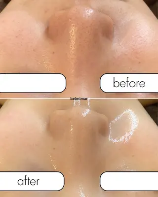 南森町・肌質改善 BELMIMARのエステ・リラクイメージ