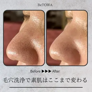 BeTOWA所属・BeTOWA 毛穴洗浄／Wax脱毛のエステ・リラクイメージ