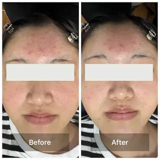 上原 巴のエステ・リラクイメージ