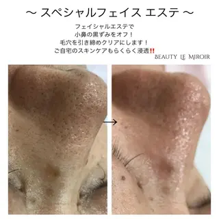 ビューティー ミロワールのエステ・リラクイメージ